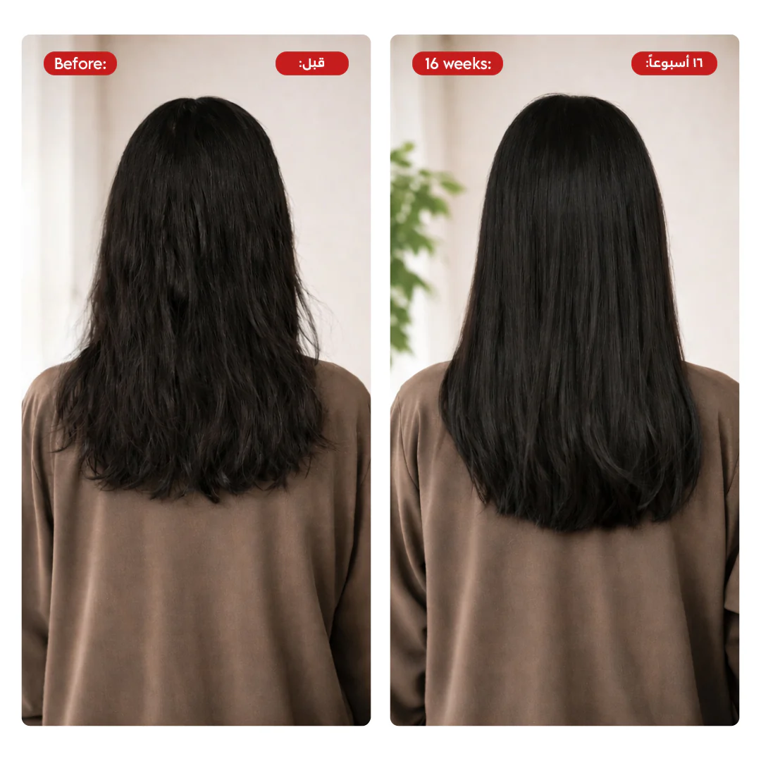 HAIR+ SET - Image 6